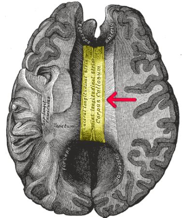 Split Brain | Definition, Experiments & Symptoms | Study.com