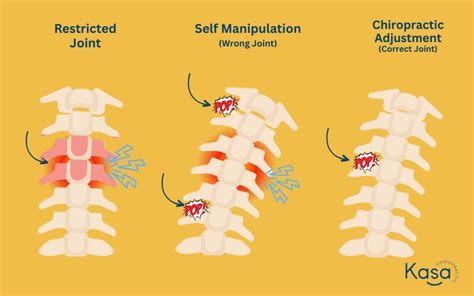 Should I be clicking my own neck? | Kasa Chiropractic