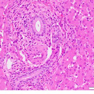 (PDF) Cholangitis and Cholangiohepatitis in Dogs: A Descriptive Study of 54 Cases Based on ...