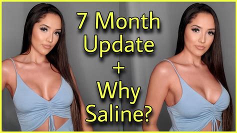 7 Month Update of 450cc Saline Breast Implants + Why I chose Saline ...