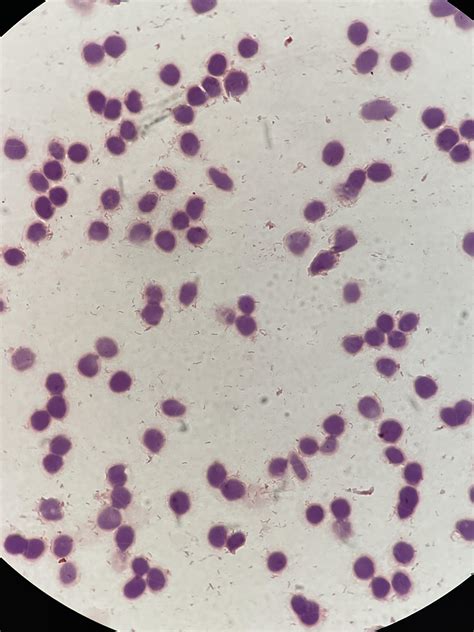 Direct Gram stain from a positive blood culture (flagged + on Day 4 ...