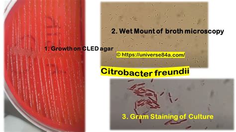 Citrobacter freundii: Introduction, Morphology, Pathogenicity, Lab ...