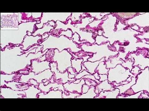 Simple Squamous Epithelium Slide