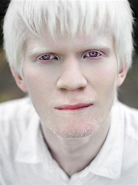 Eric Lafforgue, Steve Mccurry, Albino Human, Modelo Albino, Albino ...