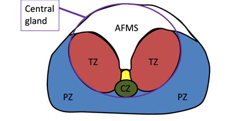 Central Zone Prostate Mri : Prostate sector map. AS = anterior ...