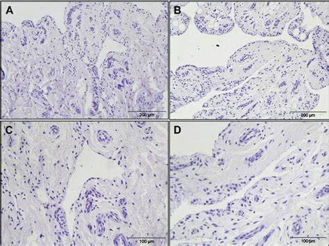 Representative histological sections of synovial membrane harvested... | Download Scientific Diagram