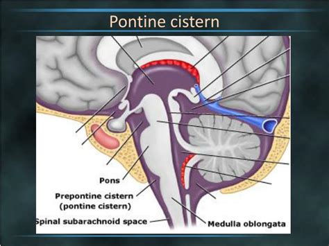 PPT - Brain Cisterns PowerPoint Presentation - ID:2263744