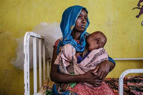 Ethiopia: Thousands of kids face 'most deadly' malnutrition - World News