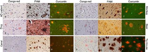 Comparison of Congo red stain (a, d, g, j, m, p), PAM stain (b, e, h,... | Download Scientific ...