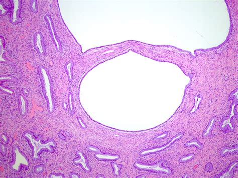 Pathology Outlines - Histology