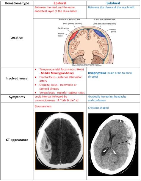 Subdural Hematoma Vs Epidural Hematoma - slidesharetrick