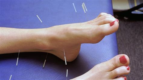 A Close-up Look at Acupuncture for Pain - ABC News