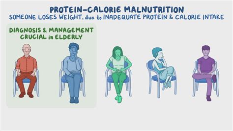 Protein-calorie malnutrition: Clinical sciences - Osmosis Video Library