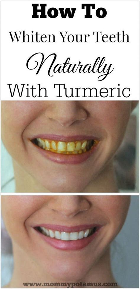 15 NATURAL Ways to Whiten Your Teeth: Homemade Teeth Whiteners - Fashion Daily