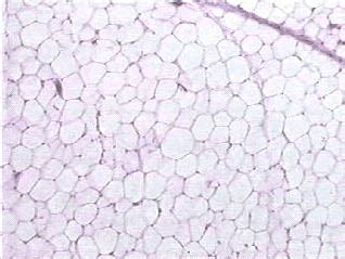 Adipose Tissue Histology - Adipose tissue - histology slide