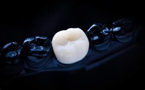 How 3D Printing Teeth Is Transforming the Dental Industry – TechAcute