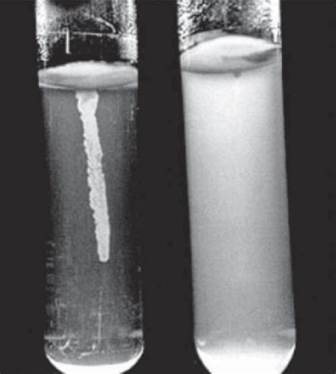 12. Motility test specimen. | Download Scientific Diagram