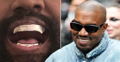 Kanye West fans freak out thinking he's removed all his teeth | Metro News