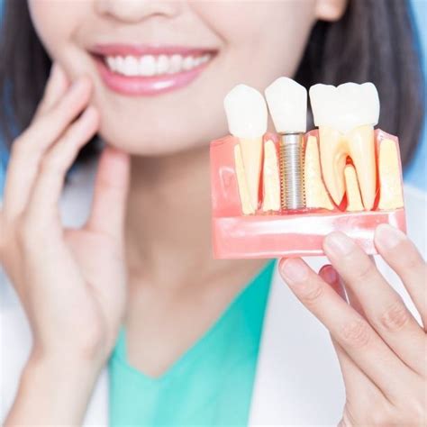 Dental Implants Plano, TX | Tooth Replacement Options | Cost of Dental Implants | Westpark ...