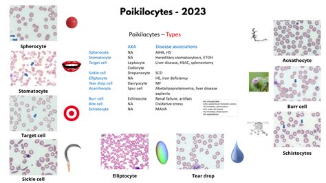 Poikilocytes in History • The Blood Project