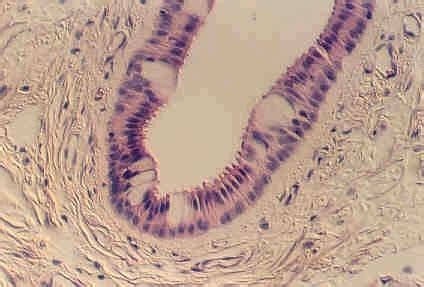 STRATIFIED COLUMNAR OR CUBOIDAL EPITHELIUM | Microanatomy Web Atlas | Gwen V. Childs, Ph.D.