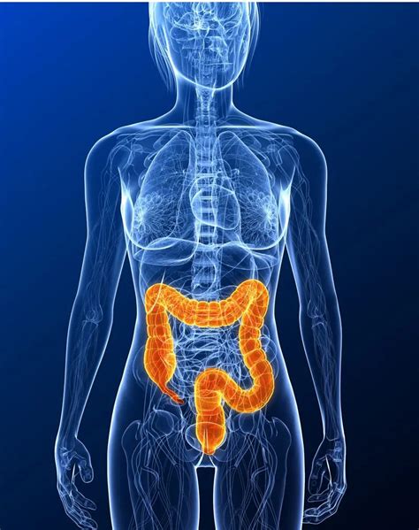 Il tumore del colon e del retto | Cuccomarino, MD