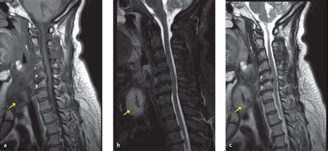 37 Thyroid Mass | Radiology Key