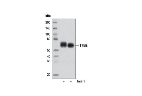 TFEB Antibody | Cell Signaling Technology