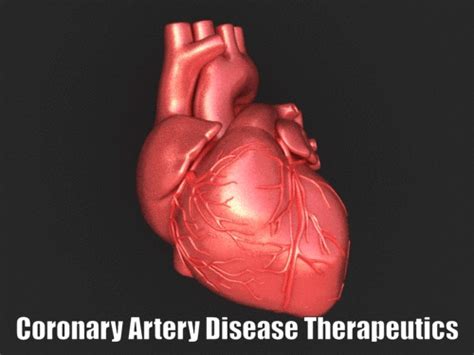 Coronary Artery Disease Therapeutics Market Research Report by Product Opportunity in 2021 ...