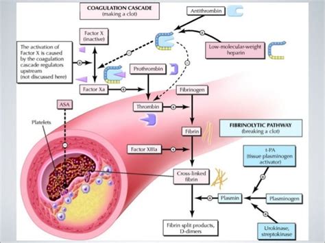 Therapy: Fibrinolytic Therapy