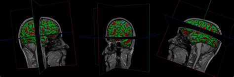 iLab Organizer :: Center for Advanced Human Brain Imaging Research