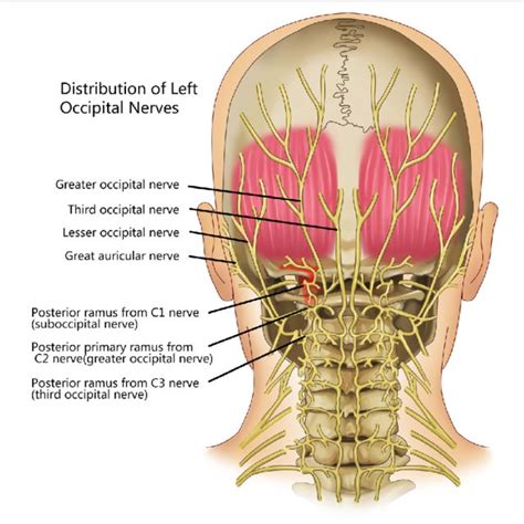 X-ray revealed obvious anterior atlantoaxial dislocation (left), which... | Download Scientific ...