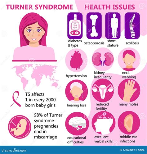 Turner Syndrome Infographic Vector. Signs, Health Issues. Short Stature ...