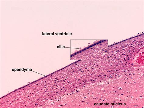 ventricle brain histology