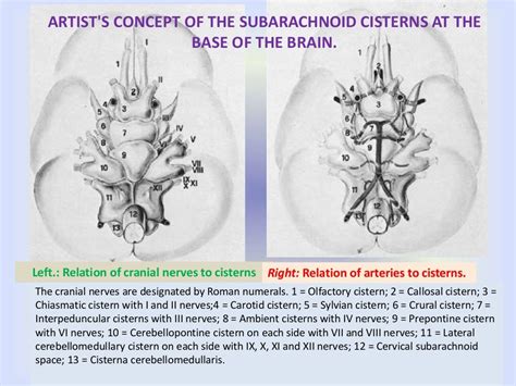 Cisterns of brain