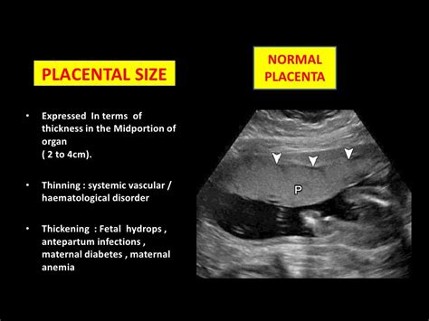 Placental grading