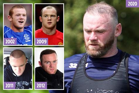 Wayne Rooney’s hair is thinning again — despite spending ‘£30k’ on hair transplants – The Irish ...