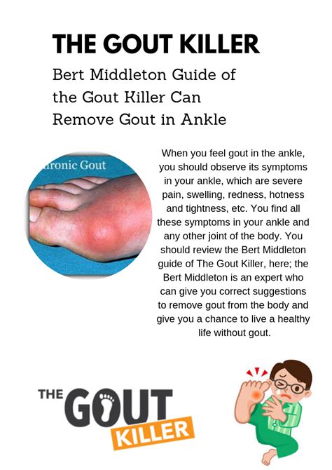 https://www.thegoutkiller.com/what-is-gout/what-does-gout-look-like/gout-in-ankle/ #gout_in ...