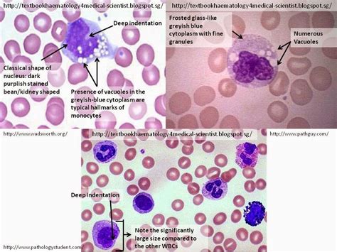 Haematology in a NutShell: Monocytes