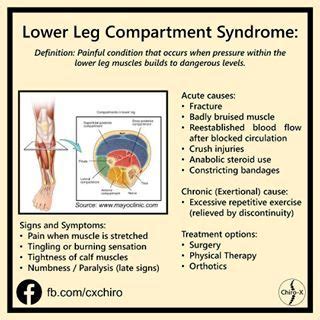 All about Lower Leg Compartment Syndrome. Share this with your fellow ...