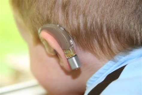 Hearing Loss and Assistive Listening Devices - HubPages