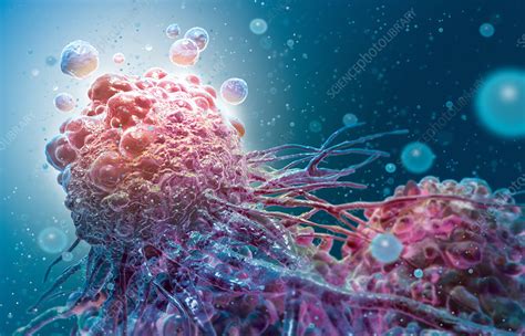 Cancer Cell Apoptosis - Stock Image - C030/7081 - Science Photo Library