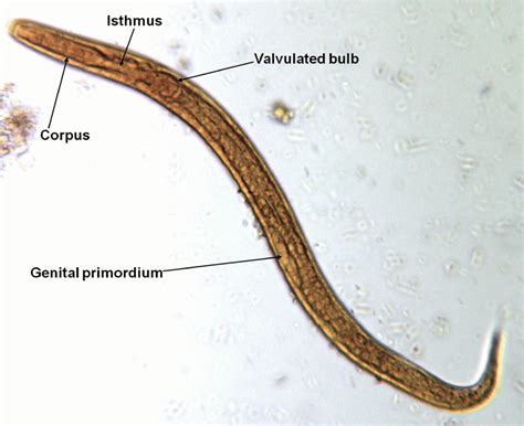 What are Strongyloides? - Creative Diagnostics