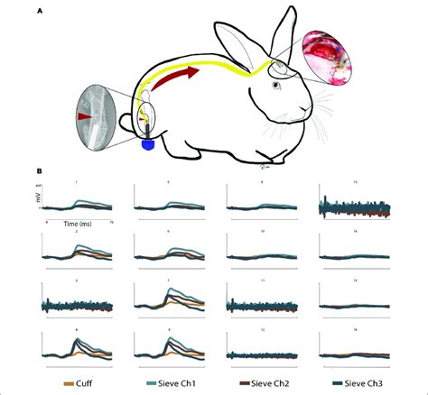 | Somatosensory evoked potentials: (A) Schematic representation of... | Download Scientific Diagram