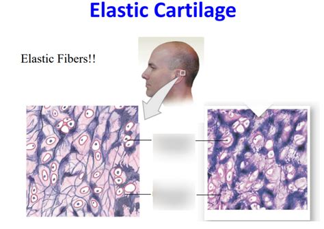 elastic cartilage Diagram | Quizlet