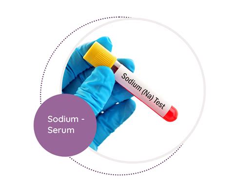 Sodium - Serum - MediScan Lab