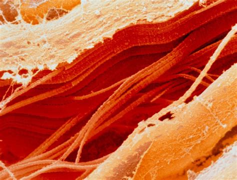 Food Under The Microscope - Gallery | eBaum's World