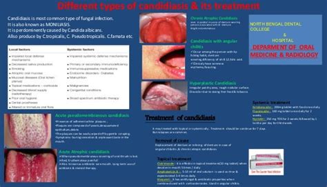 Oral Candidiasis (Poster)