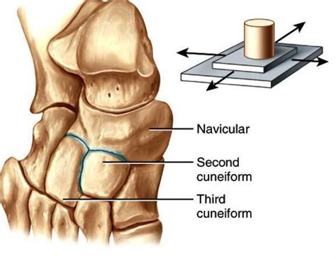 Plane joint (gliding joint) : one type of synovial joint. Uniaxial . Permit gliding movement ...