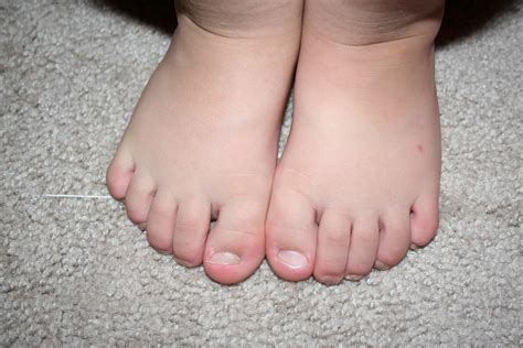 big fat marshmallow feet | katastrofee4 | Flickr